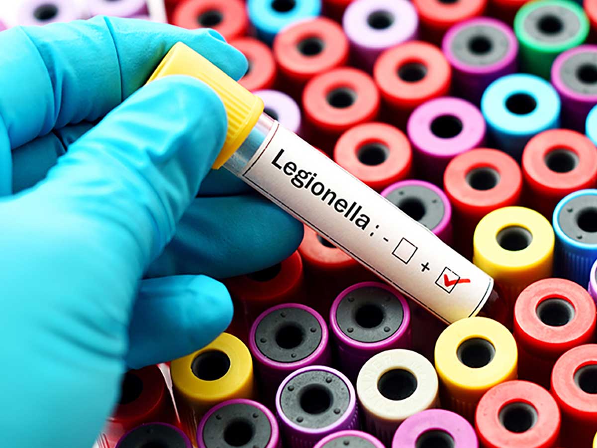 Closeup of a hand in a latex glove holding a positive test for Legionella