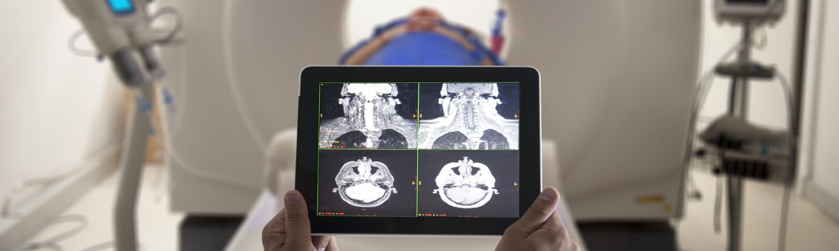 Hands holding a tablet displaying scans in front of an MRI machine.