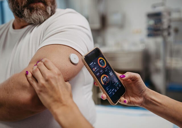 Close up a nurse using a mobile device to scan a patient's CGM
