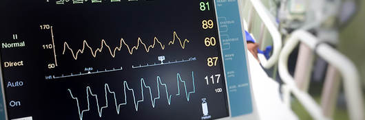 Close-up of an electrocardiogram monitor in a hospital room