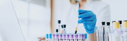 Close up of lab assistant holding test tube while wearing a lab coat, mask and rubber gloves