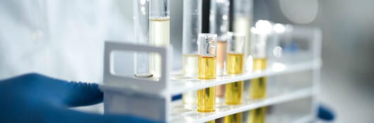 A closeup of a lab technician holding a tray of CBD oils in test tubes