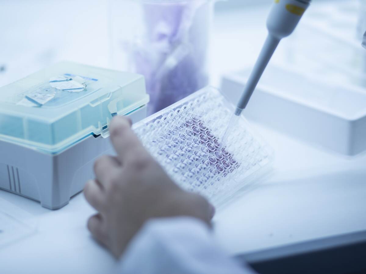 Cell culture in the lab