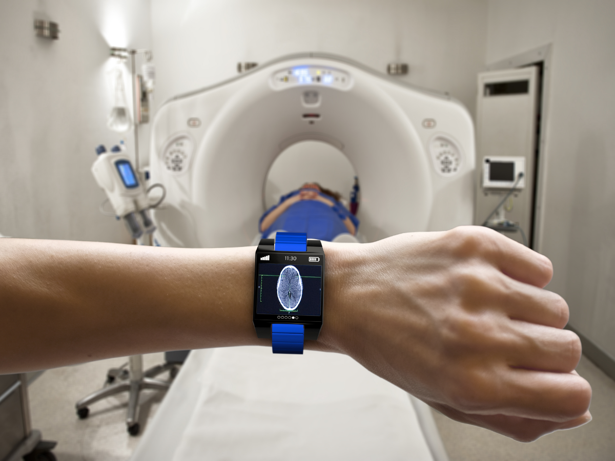 smart watch reading ct scan results