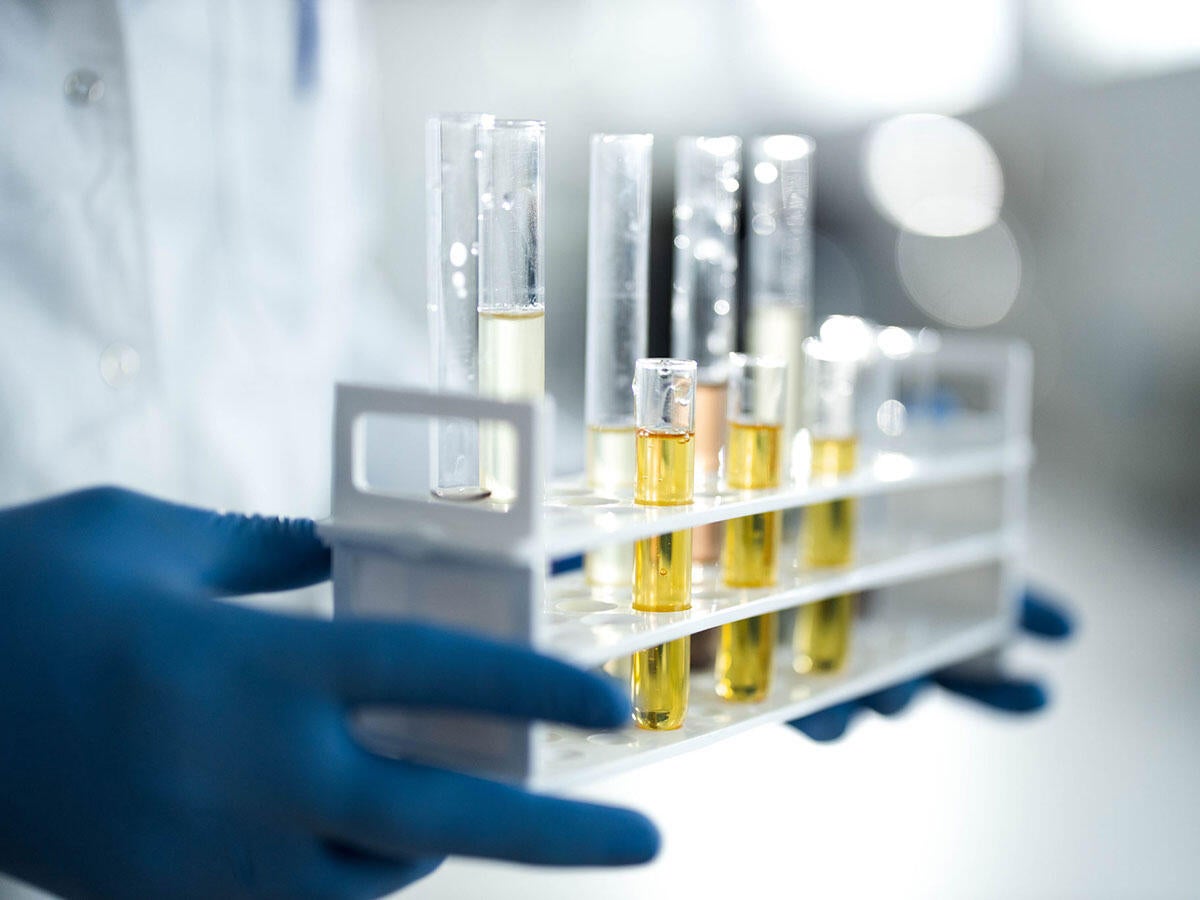 A closeup of a lab technician holding a tray of CBD oils in test tubes