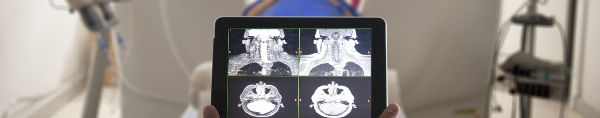 Hands holding a tablet displaying scans in front of an MRI machine.