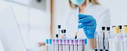 Laboratory technician working on laptop and handling test tubes