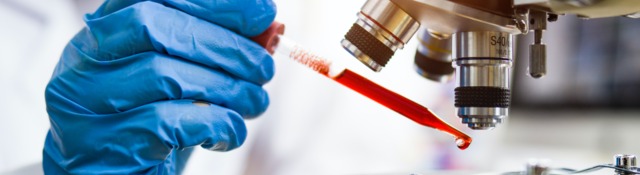 A scientist drips a red liquid onto a microscope’s slide