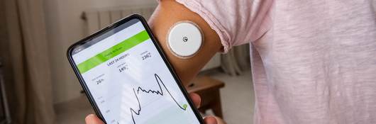 Monitoring the levels of glucose in blood using smart phone technology and electrode.