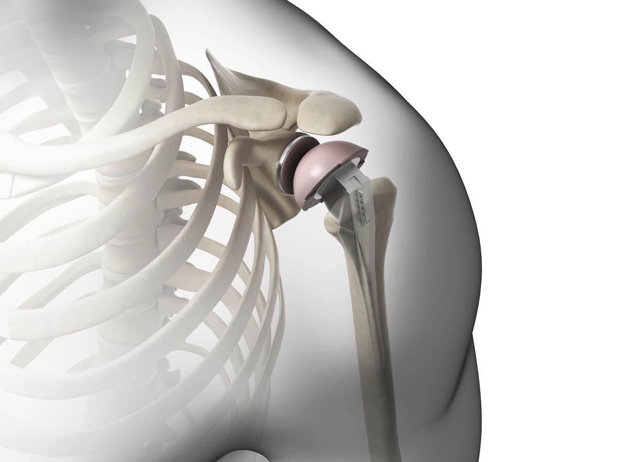 Updates On 3d Printed Medical Devices Ul
